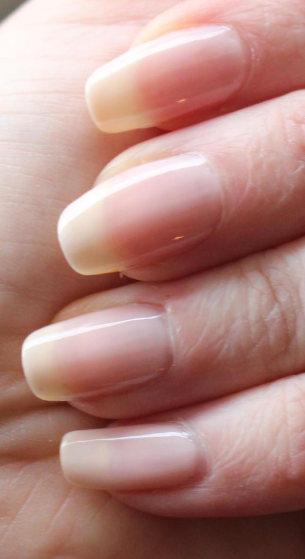 CND