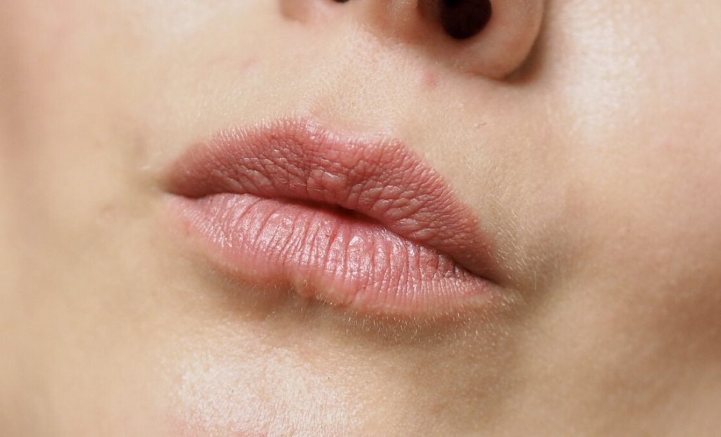 Ofra Pasadena 
