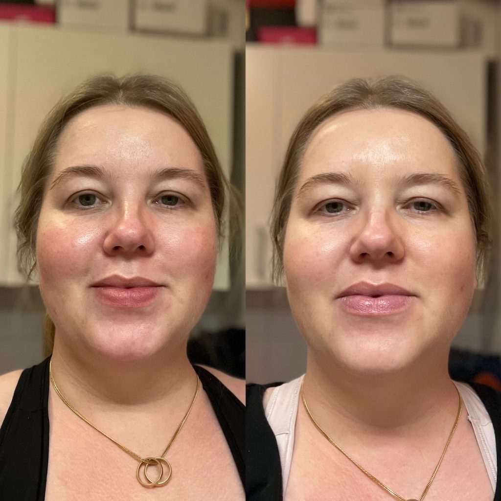 Left with no makeup. Right with Intant energizing corrector only.