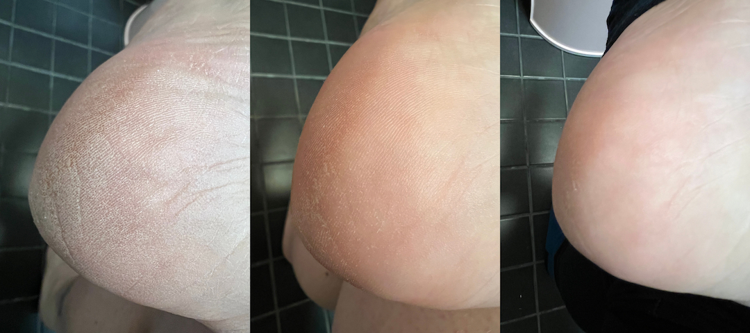 Effortless Body Peel Mask result